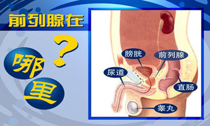 前列腺炎的危害