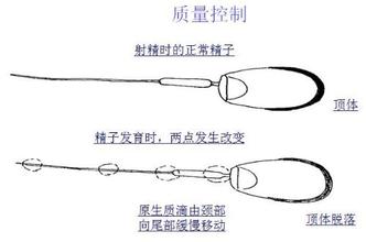 引起精子畸形率高的原因